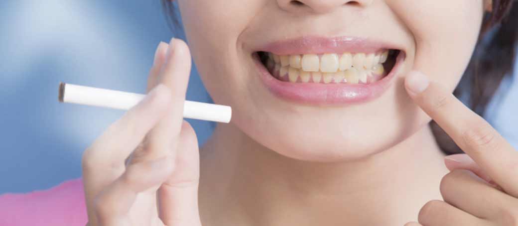 El tabaco y su impacto en la salud bucal