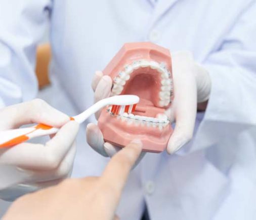 Los mitos más comunes sobre Salud Dental ¿verdadero o falso?
