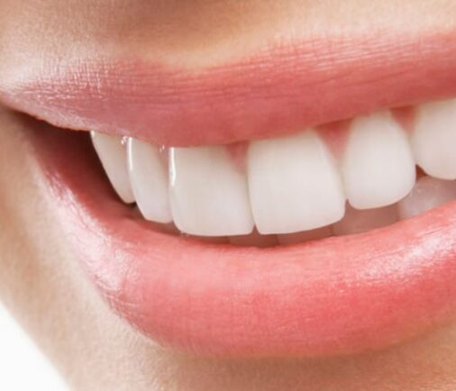 Alta Estética Dental: Más que una sonrisa bonita