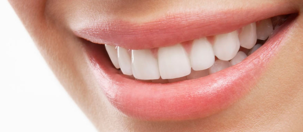 Alta Estética Dental: Más que una sonrisa bonita